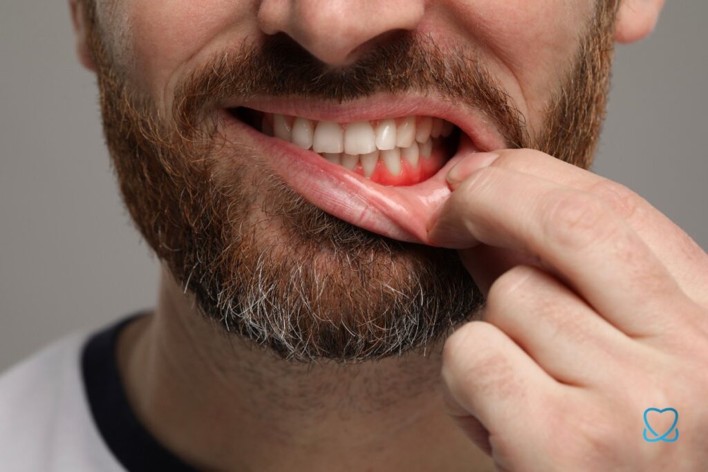 obrazek przedstawia wrażliwe na chłód zęby