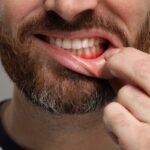 obrazek przedstawia wrażliwe na chłód zęby